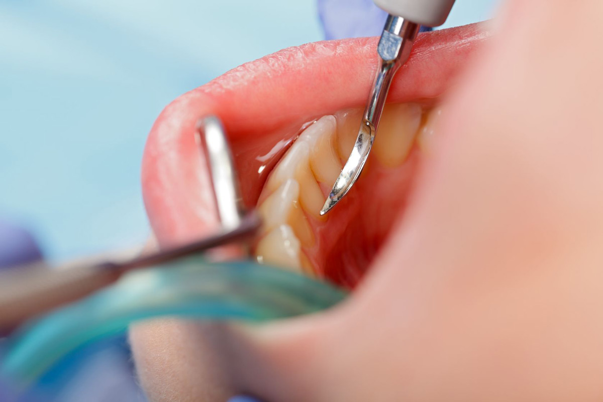 parodontologija-i-oralna-medicina